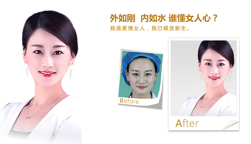 重庆V脸、线雕隆鼻